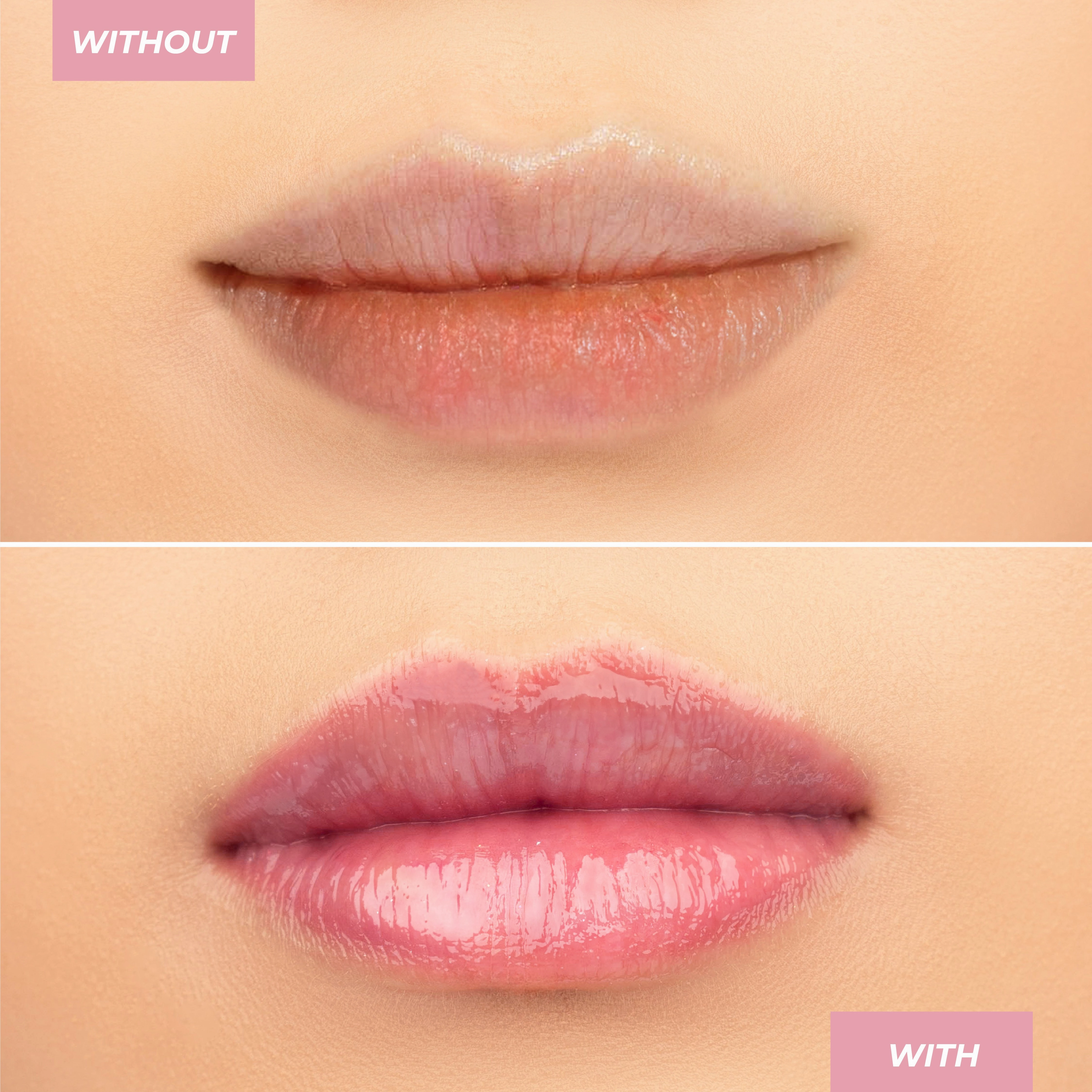 Lip Whip Intense Repair Balm